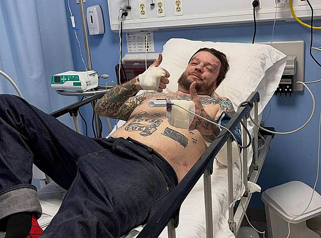 Hvězda Mistrů zastavárny shání peníze na léčbu po úrazu na motorce