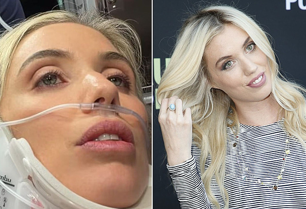 Děsivá nehoda známé influencerky. Lednice ji málem připravila o život