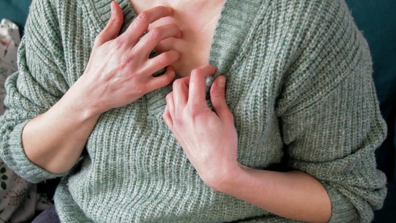 PŘEHLEDNĚ: Atopický ekzém trápí děti i dospělé. Proč vzniká, jak se projevuje a co pomáhá?